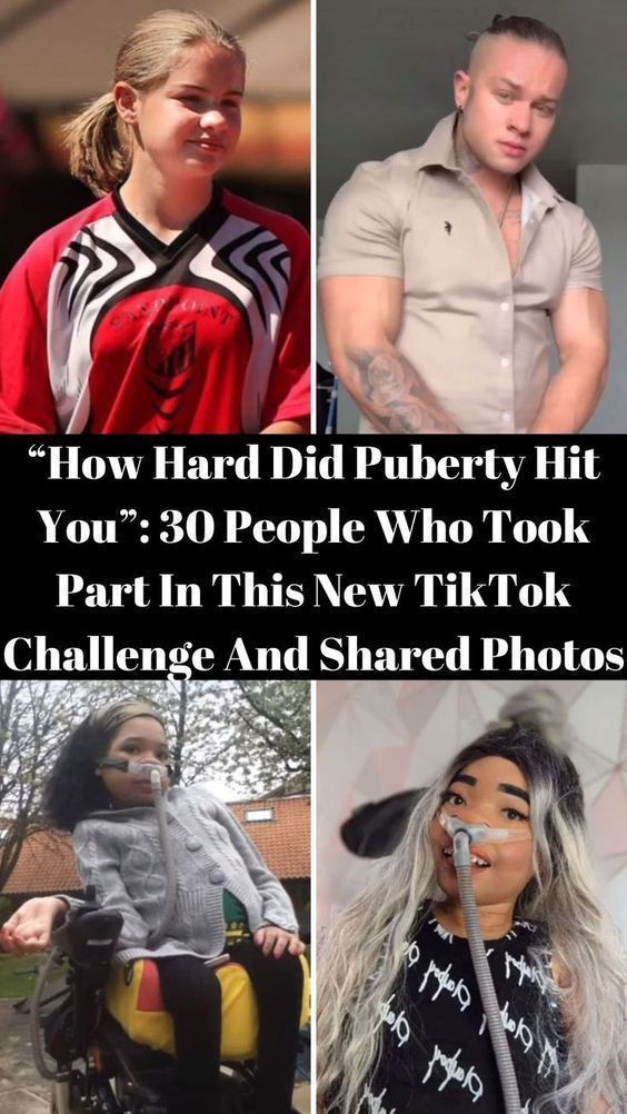 “How Hard Did Puberty Hit You”: 30 People Who Took Part In This New TikTok Challenge And Shared Photos